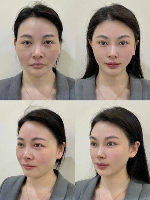 50岁抗皱紧致十大品牌给你紧致肌肤CQ9